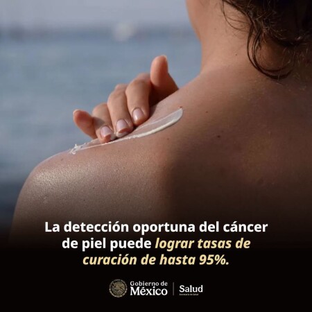 La detección oportuna de cáncer de piel  puede lograr tasas de curación de hasta 95% en los casos identificados en etapas tempranas.